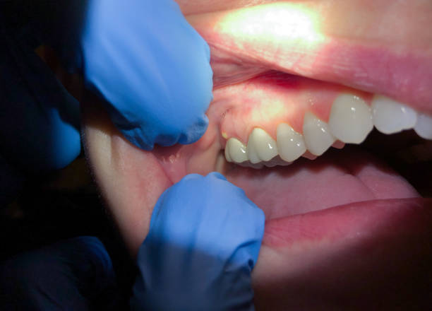 Best Mobile Emergency Dentist in Mount Gay Shamrock, WV