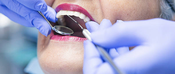 Best Emergency Dentist for Lost Fillings or Crowns in Mount Gay Shamrock, WV